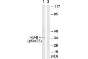Western blot analysis of extracts from HeLa cells treated with TNF-a 20ng/ml 5', using IkappaB-beta (Phospho-Ser23) Antibody.