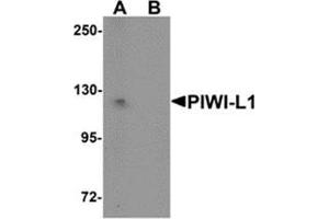 Image no. 1 for anti-Piwi-Like 1 (PIWIL1) (N-Term) antibody (ABIN783767)