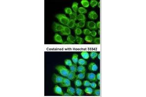 Complement C2 antibody  (Center)