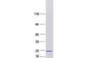 TRAPPC6A Protein (Myc-DYKDDDDK Tag)