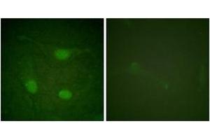 Immunofluorescence analysis of HeLa cells, using Elk3 (Phospho-Ser357) Antibody.