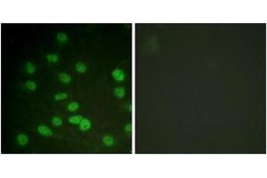 Immunofluorescence analysis of HuvEc cells treated with serum 20% 30', using DDX3/DEAD-box Protein 3 (Phospho-Thr322) Antibody.