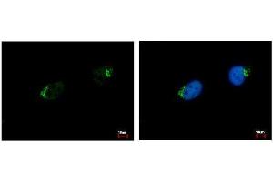 Image no. 1 for anti-UDP-N-Acetyl-alpha-D-Galactosamine:polypeptide N-Acetylgalactosaminyltransferase 7 (GalNAc-T7) (GALNT7) (Center) antibody (ABIN2856251)