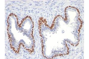 Image no. 2 for anti-Tumor Protein P63 (TP63) antibody (ABIN6940964)