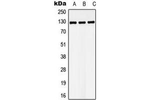 Image no. 1 for anti-LATS, Large Tumor Suppressor, Homolog 1 (Drosophila) (LATS1) (C-Term) antibody (ABIN2704958)