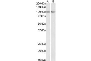 Image no. 2 for anti-Tripartite Motif Containing 71, E3 Ubiquitin Protein Ligase (TRIM71) (AA 390-402) antibody (ABIN571137)