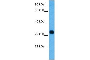 Image no. 3 for anti-Cyclin D3 (CCND3) (C-Term) antibody (ABIN2792167)