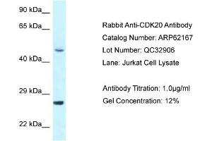 Image no. 1 for anti-Cyclin-Dependent Kinase 20 (CDK20) (N-Term) antibody (ABIN2789044)