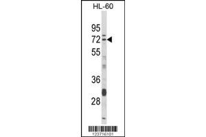 Western Blotting (WB) image for anti-Deltex Homolog 4 (Drosophila) (DTX4) antibody (ABIN2158611)
