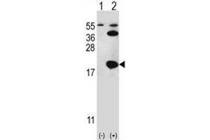 Image no. 2 for anti-Ubiquitin-Conjugating Enzyme E2I (UBE2I) (AA 1-30) antibody (ABIN3029438)