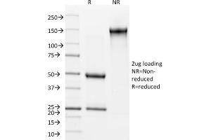 Image no. 8 for anti-Keratin 15 (KRT15) antibody (ABIN6939913)