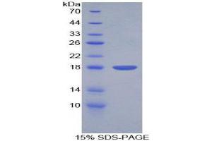 Image no. 1 for Platelet-Derived Growth Factor beta Polypeptide (PDGFB) (AA 82-190) protein (His tag) (ABIN1980800)