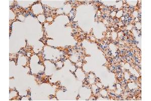 Image no. 11 for anti-GATA Binding Protein 4 (GATA4) (pSer105) antibody (ABIN6256094)