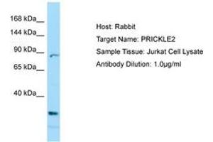 Image no. 1 for anti-Prickle Homolog 2 (PRICKLE2) (C-Term) antibody (ABIN6749993)