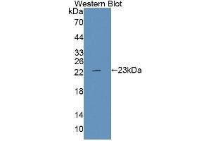 Image no. 1 for anti-Protein tyrosine Phosphatase, Receptor Type, E (PTPRE) (AA 346-500) antibody (ABIN5014199)