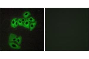 Image no. 1 for anti-Vesicle-Associated Membrane Protein 4 (VAMP4) (AA 1-50) antibody (ABIN1532787)