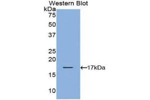 Image no. 1 for anti-T-Cell Leukemia/lymphoma 1A (TCL1A) (AA 1-114) antibody (ABIN1860692)