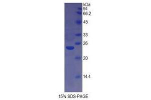 Image no. 1 for HLA Class II DR alpha (HLA-DRA) (AA 26-216) protein (His tag) (ABIN1878858)