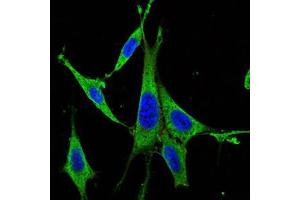Image no. 7 for anti-Mitogen-Activated Protein Kinase 3 (MAPK3) antibody (ABIN969277)