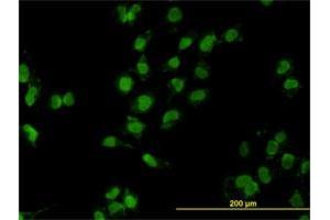 Image no. 10 for anti-Mesenchyme Homeobox 2 (MEOX2) (AA 1-303) antibody (ABIN561806)
