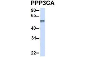 Image no. 5 for anti-Protein Phosphatase 3, Catalytic Subunit, alpha Isoform (PPP3CA) (Middle Region) antibody (ABIN2784524)