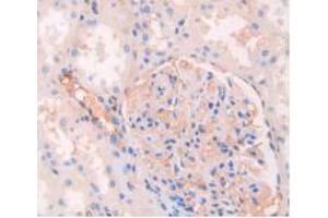 Immunohistochemistry (Paraffin-embedded Sections) (IHC (p)) image for Rabbit anti-Human IgG4 (AA 222-327) antibody (ABIN2862700)