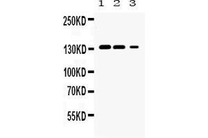 Image no. 1 for anti-Janus Kinase 1 (JAK1) (AA 78-115), (N-Term) antibody (ABIN5518768)
