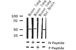 Image no. 1 for anti-Runt-Related Transcription Factor 1 (RUNX1) (pSer303) antibody (ABIN6256258)