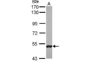 Image no. 2 for anti-4-Aminobutyrate Aminotransferase (ABAT) (C-Term) antibody (ABIN2854328)