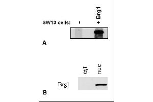 Image no. 1 for anti-SWI/SNF Related, Matrix Associated, Actin Dependent Regulator of Chromatin, Subfamily A, Member 4 (SMARCA4) (C-Term) antibody (ABIN343708)