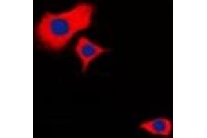 Image no. 1 for anti-Heat Shock 27kDa Protein 2 (HSPB2) (C-Term) antibody (ABIN2801250)