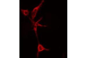 ABIN6274808 staining COLO205 cells by IF/ICC.