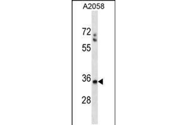 anti-Spermatid Maturation 1 (SPEM1) (AA 115-143) antibody