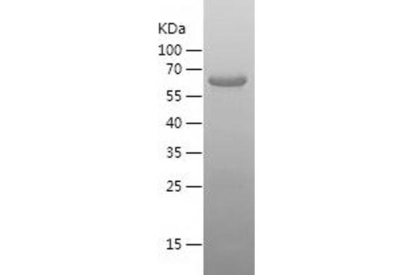 PRCC Protein (AA 215-491) (His-IF2DI Tag)