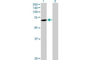 SLC27A6 antibody  (AA 1-619)