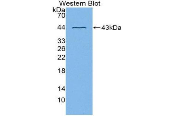 anti-ADAM Metallopeptidase Domain 8 (ADAM8) (AA 145-493) antibody