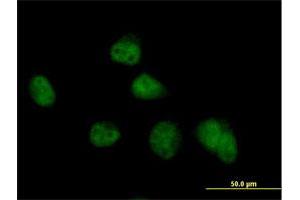 Image no. 4 for anti-COP9 Signalosome Subunit 8 (COPS8) (AA 1-209) antibody (ABIN524327)