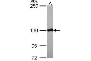 WB Image Sample (30 ug of whole cell lysate) A: JurKat 5% SDS PAGE antibody diluted at 1:3000
