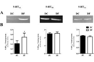 Image no. 1 for anti-Serotonin Receptor 1D (HTR1D) antibody (ABIN3181713)