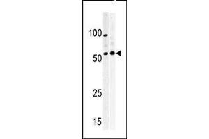 Image no. 1 for anti-Protein Kinase, Membrane Associated tyrosine/threonine 1 (PKMYT1) (AA 452-482), (C-Term) antibody (ABIN391292)
