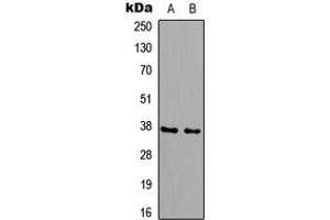 Image no. 1 for anti-UDP-Gal:betaGal beta 1,3-Galactosyltransferase Polypeptide 6 (B3GALT6) (Center) antibody (ABIN2705556)