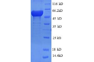 RRM2 Protein (AA 1-389, full length) (His-SUMO Tag)