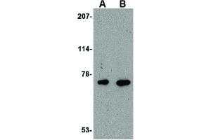 Image no. 1 for anti-Apoptosis-Inducing Factor, Mitochondrion-Associated, 3 (AIFM3) (Internal Region) antibody (ABIN6656625)