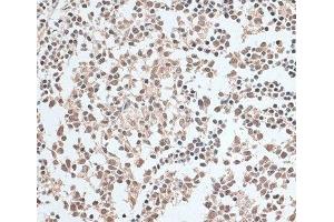 Immunohistochemistry of paraffin-embedded Human tonsil using ZNF346 Polyclonal Antibody at dilution of 1:100 (40x lens).