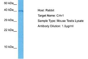Image no. 2 for anti-Corticotropin Releasing Hormone Receptor 1 (CRHR1) (C-Term) antibody (ABIN2789561)