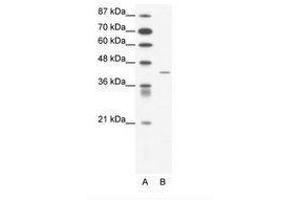 Image no. 1 for anti-Somatostatin Receptor 4 (SSTR4) (AA 163-212) antibody (ABIN202399)