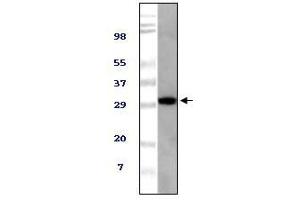 Image no. 1 for anti-Alveolar Soft Part Sarcoma Chromosome Region, Candidate 1 (ASPSCR1) antibody (ABIN1724649)