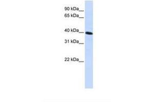 anti-Carbohydrate Kinase Domain Containing (Carkd) (AA 144-193) antibody