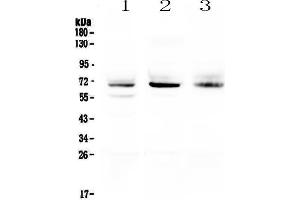 Image no. 1 for anti-Bestrophin 1 (BEST1) antibody (ABIN5692801)