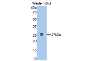 WB of Protein Standard: different control antibodies  against Highly purified E.